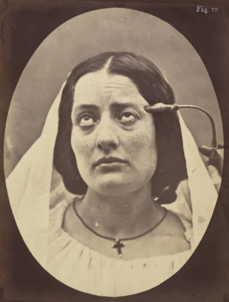 JEZIVE SLIKE LIJEČNIČKIH POKUSA IZ 19. STOLJEĆA: Ova lica će vas proganjati i dok spavate