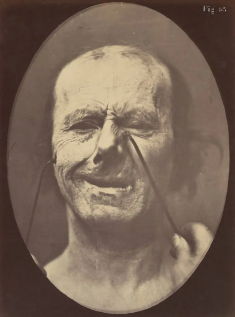 JEZIVE SLIKE LIJEČNIČKIH POKUSA IZ 19. STOLJEĆA: Ova lica će vas proganjati i dok spavate