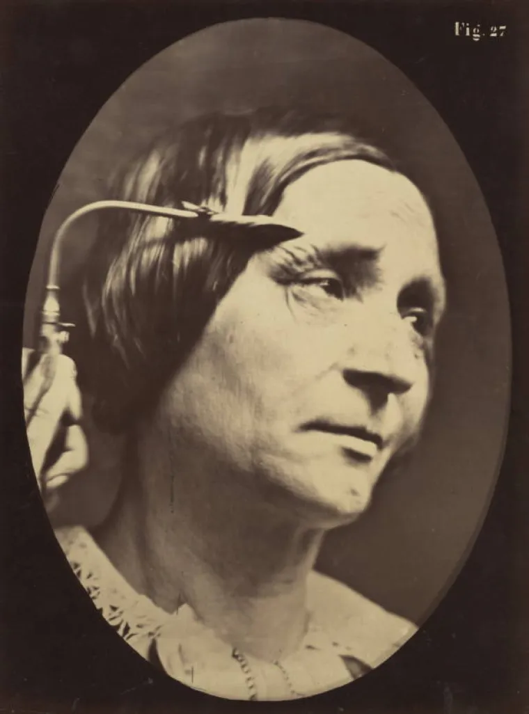 JEZIVE SLIKE LIJEČNIČKIH POKUSA IZ 19. STOLJEĆA: Ova lica će vas proganjati i dok spavate