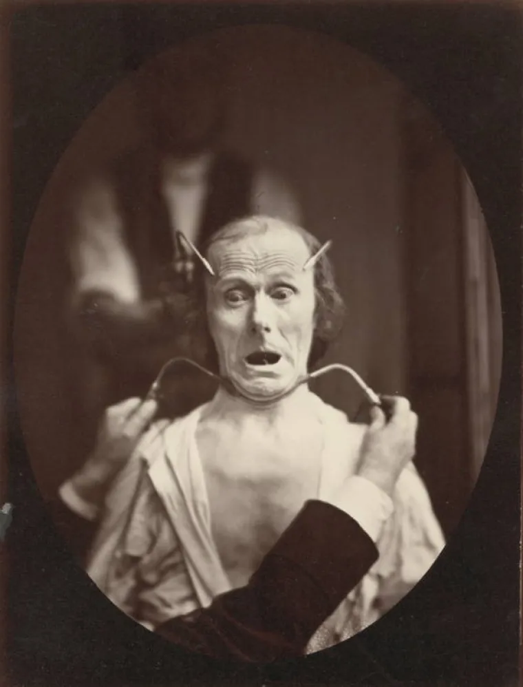 JEZIVE SLIKE LIJEČNIČKIH POKUSA IZ 19. STOLJEĆA: Ova lica će vas proganjati i dok spavate