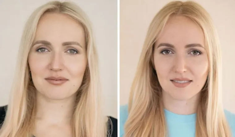 Fotografije majki prije i poslije poroda postale su viralne: Vidite li razliku?