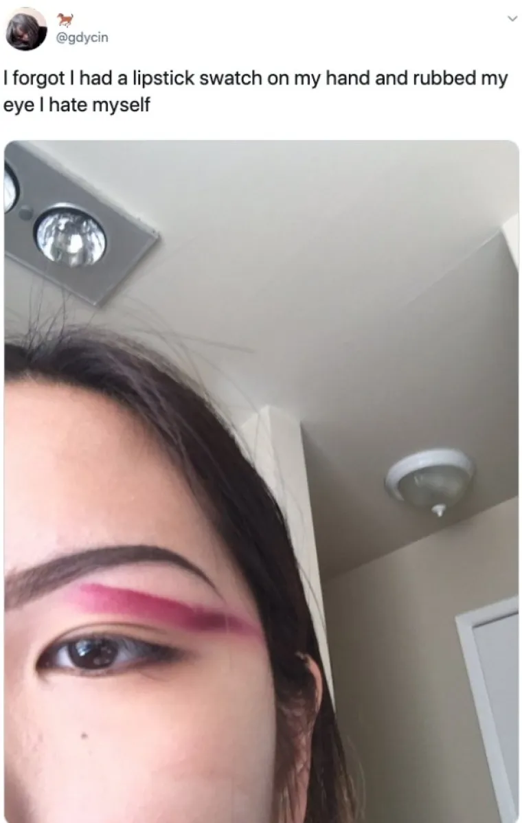 NAJVEĆE 'BEAUTY' KATASTROFE: Željele su se uljep&scaron;ati, a zavr&scaron;ile su u suzama