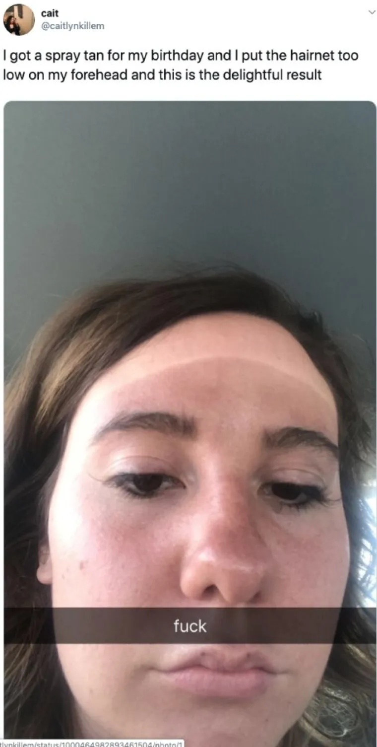 NAJVEĆE 'BEAUTY' KATASTROFE: Željele su se uljep&scaron;ati, a zavr&scaron;ile su u suzama