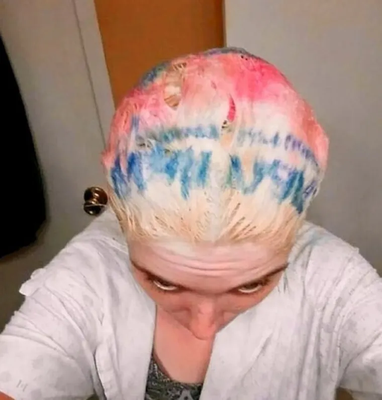 NAJVEĆE 'BEAUTY' KATASTROFE: Željele su se uljep&scaron;ati, a zavr&scaron;ile su u suzama