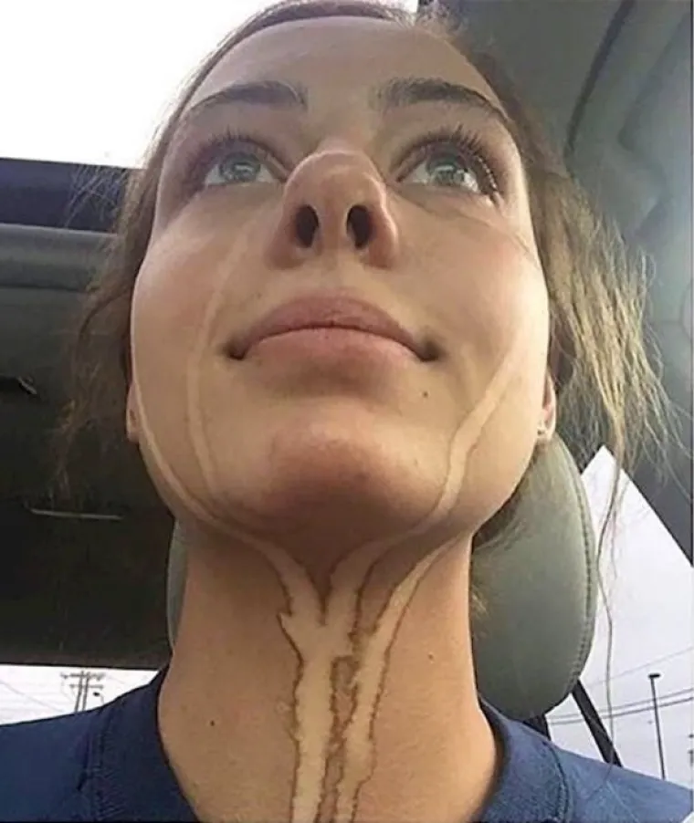 NAJVEĆE 'BEAUTY' KATASTROFE: Željele su se uljep&scaron;ati, a zavr&scaron;ile su u suzama