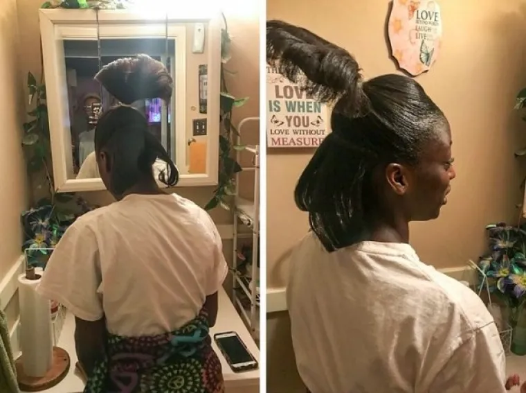 NAJVEĆE 'BEAUTY' KATASTROFE: Željele su se uljep&scaron;ati, a zavr&scaron;ile su u suzama