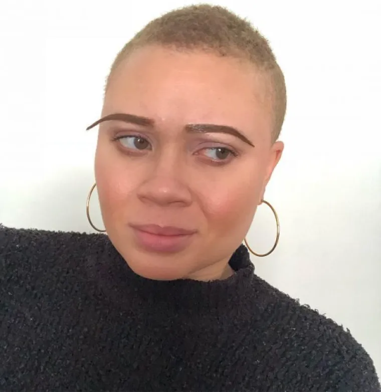 NAJVEĆE 'BEAUTY' KATASTROFE: Željele su se uljep&scaron;ati, a zavr&scaron;ile su u suzama