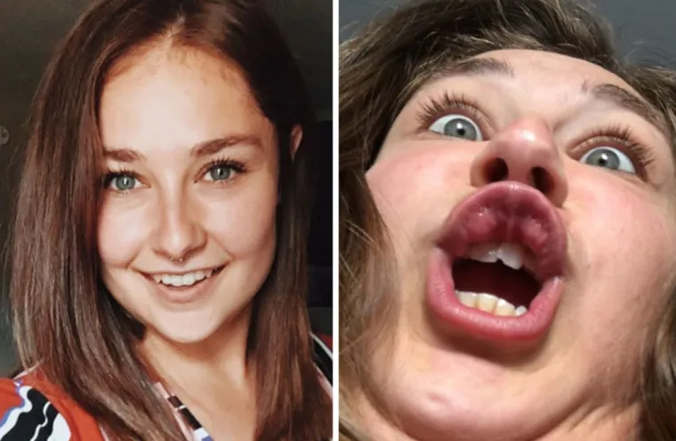 DJEVOJKE OTKRILE KAKO ZAPRAVO IZGLEDAJU: Ljepotica na Instagramu, a ustvari...