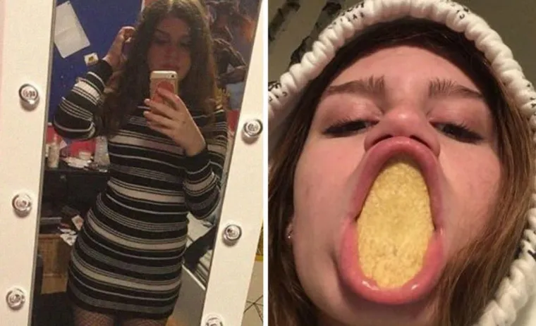 DJEVOJKE OTKRILE KAKO ZAPRAVO IZGLEDAJU: Ljepotica na Instagramu, a ustvari...
