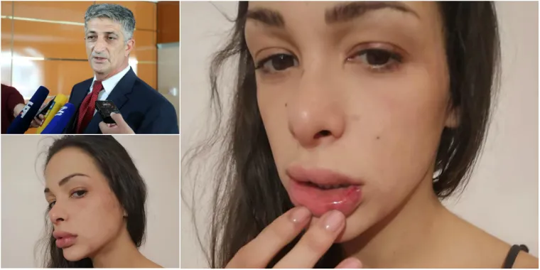 Pomoćnik ministra branitelja negira da je pretukao kćer: 'Od prve menstruacije kao da je Sotona u njoj'