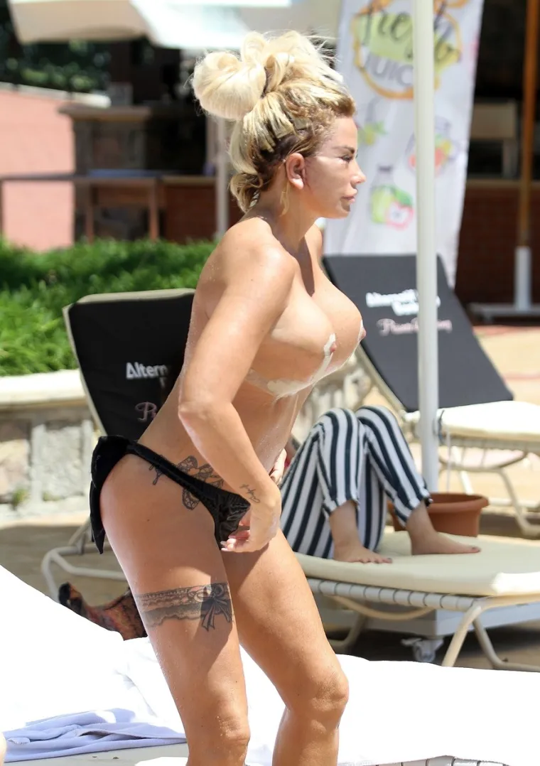 KATIE PRICE ŠOKIRALA IZGLEDOM NA BAZENU: Lice joj drže konci, a u toplesu je pokazala zavoje na grudima