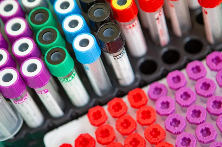 Hrvatska daleko ispod prosjeka EU: Tko tro&scaron;i najvi&scaron;e, a tko najmanje za zdravstvo u Uniji?