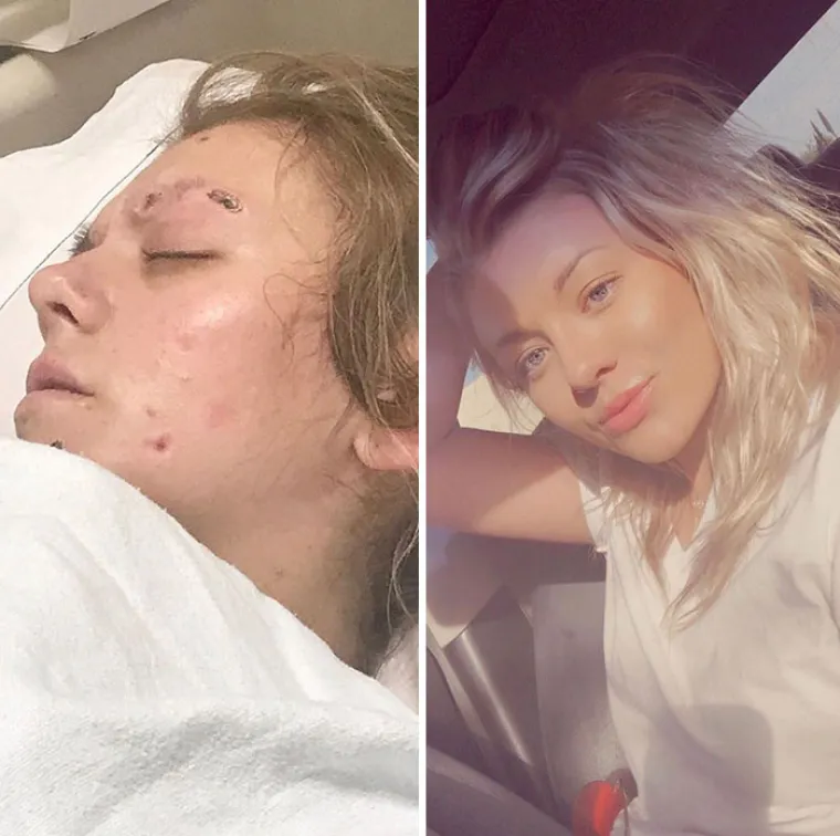 NEVJEROJATNE TRANSFORMACIJE BIV&Scaron;IH OVISNIKA: Ovih 10 fotografija ostavit će vas bez riječi