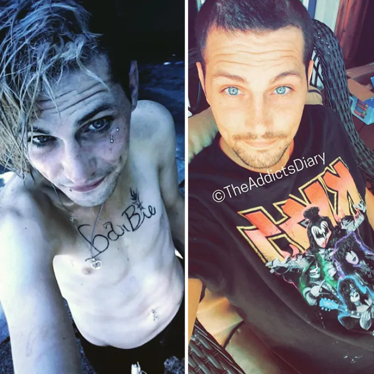 NEVJEROJATNE TRANSFORMACIJE BIV&Scaron;IH OVISNIKA: Ovih 10 fotografija ostavit će vas bez riječi