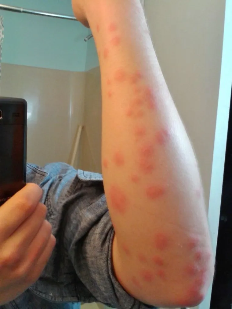 Kako to izgleda kada idete u&scaron;tedjeti: Najgori hoteli koje ne možete niti zamisliti