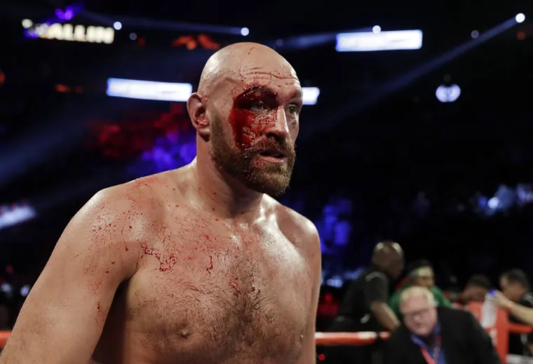 'Krvavi' Fury slomio &Scaron;veđanina nakon 12 rundi: 'Nisam ni&scaron;ta vidio'