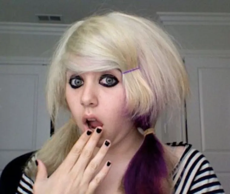 Pubertet ih nije proslavio: Postoje li sramotnije slike od onih iz te faze?