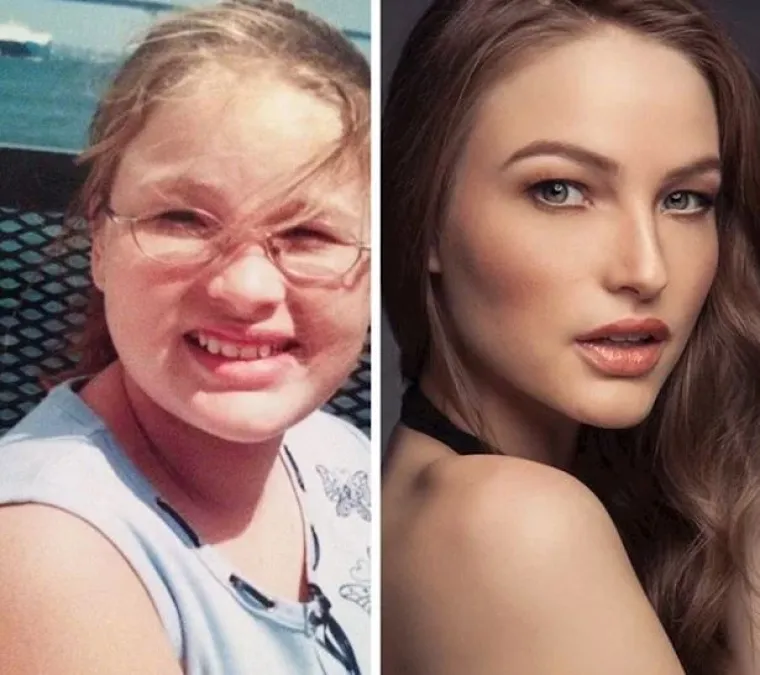 Puberty gone right: Ovo su najbolje transformacije koje ćete danas vidjeti
