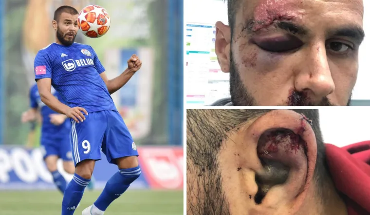 &Scaron;okantne fotografije: Slaven Belupo objavio kako izgleda njihov pretučeni nogometa&scaron;