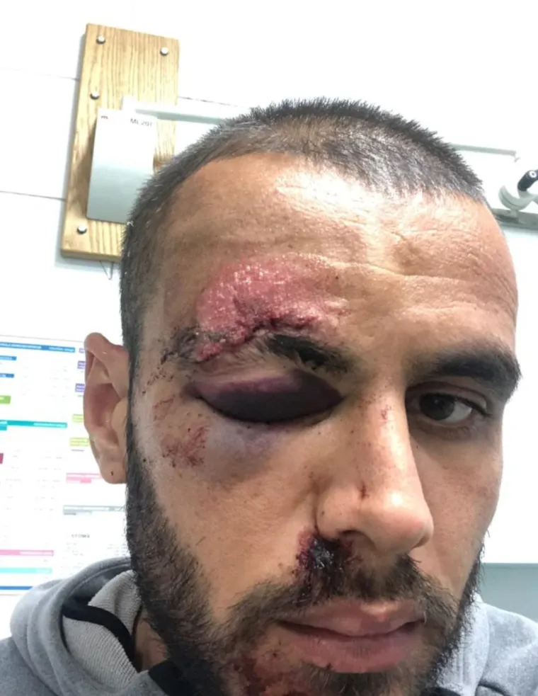 &Scaron;okantne fotografije: Slaven Belupo objavio kako izgleda njihov pretučeni nogometa&scaron;