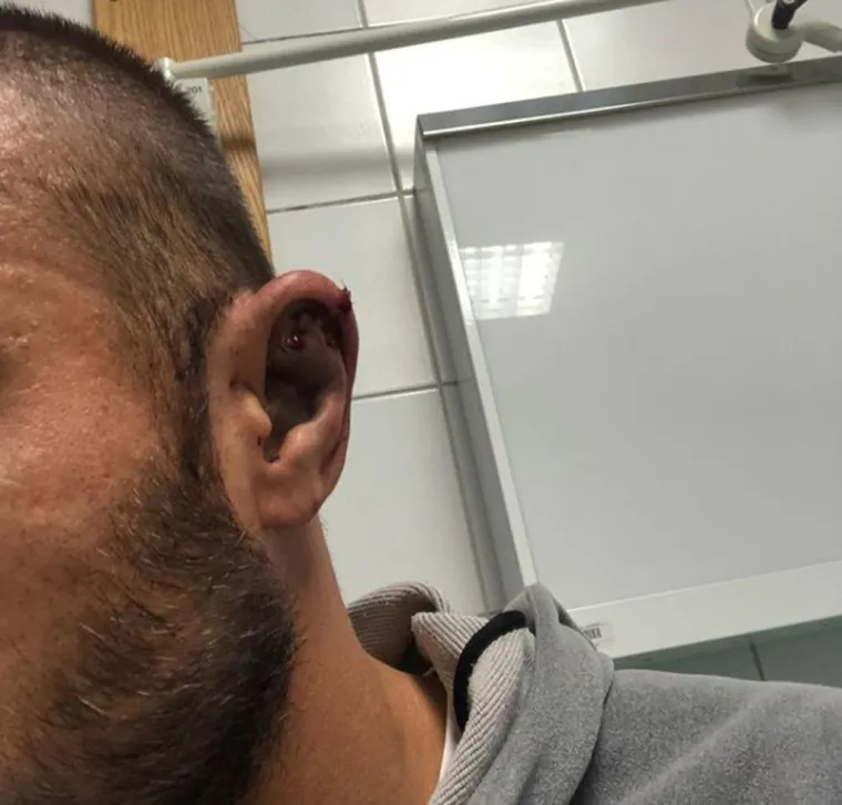 &Scaron;okantne fotografije: Slaven Belupo objavio kako izgleda njihov pretučeni nogometa&scaron;