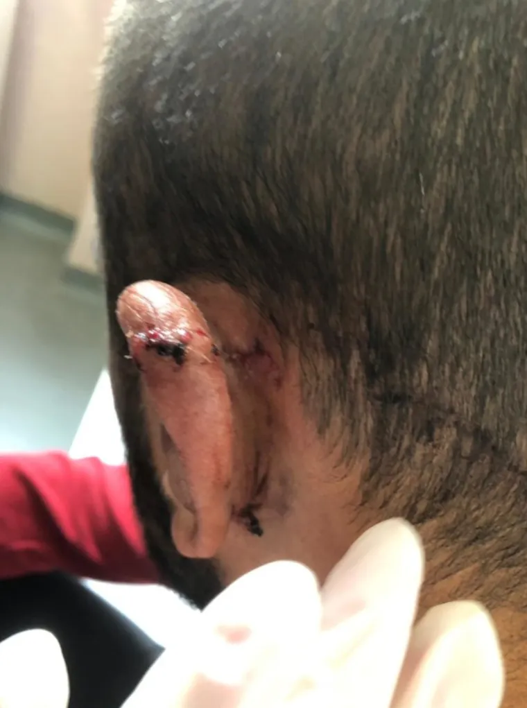 &Scaron;okantne fotografije: Slaven Belupo objavio kako izgleda njihov pretučeni nogometa&scaron;