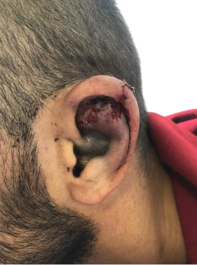 &Scaron;okantne fotografije: Slaven Belupo objavio kako izgleda njihov pretučeni nogometa&scaron;