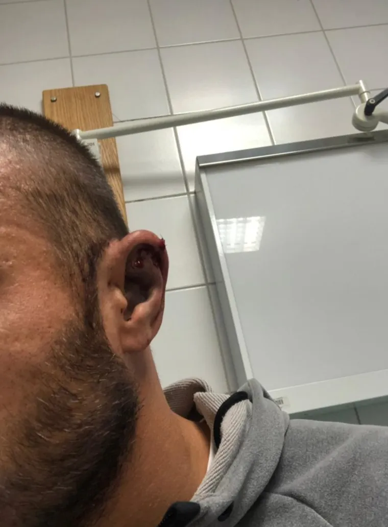 UZNEMIRUJUĆE: Slaven Belupo objavio šokantne fotografije pretučenog nogometaša