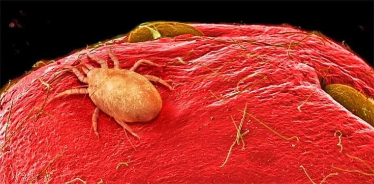 Jagoda - gotovo svaki plod u sebi ima voćne grinje, žive ili mrtve. Iako djeluje uznemirujuće, nemate se čega bojati jer su potpuno bezopasne za zdravlje.