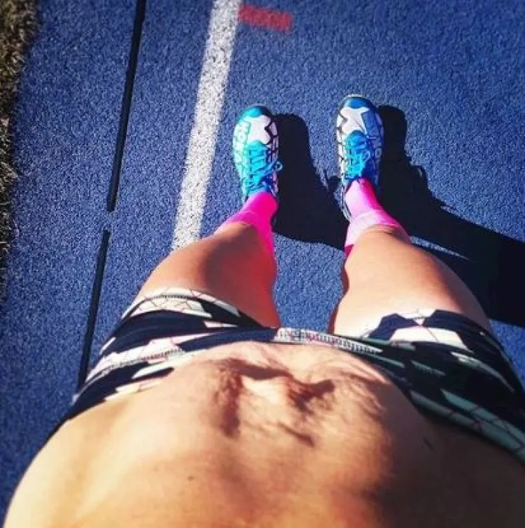 Za svaku pohvalu: 20 trudnica pokazalo svoj 'nesavr&scaron;eni' trbuh nakon poroda