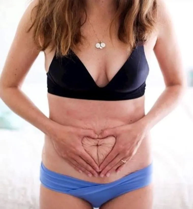 Za svaku pohvalu: 20 trudnica pokazalo svoj 'nesavr&scaron;eni' trbuh nakon poroda