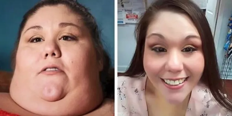 Svaka čast: 12 slučajeva ljudi koji su izgubili na kilaži nadahnut će mnoge