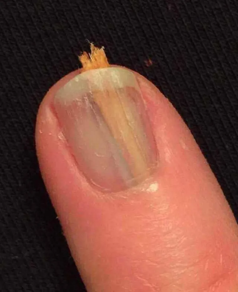 STVARNO NISU IMALI SREĆE: Ove su ljude zadesili zaista nevjerojatni pehovi