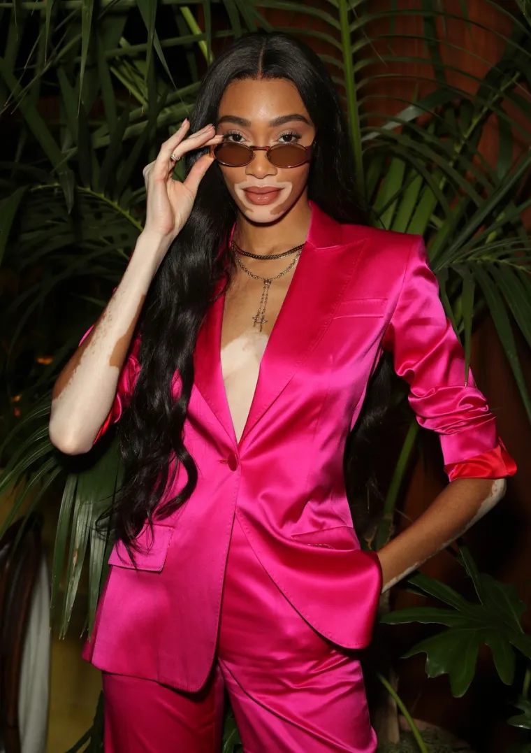 Kanadska manekenka Winnie Harlow (25) na jedan party u Los Angelesu došla je u ružičastom satenskom odijelu. Foto: Profimedia
