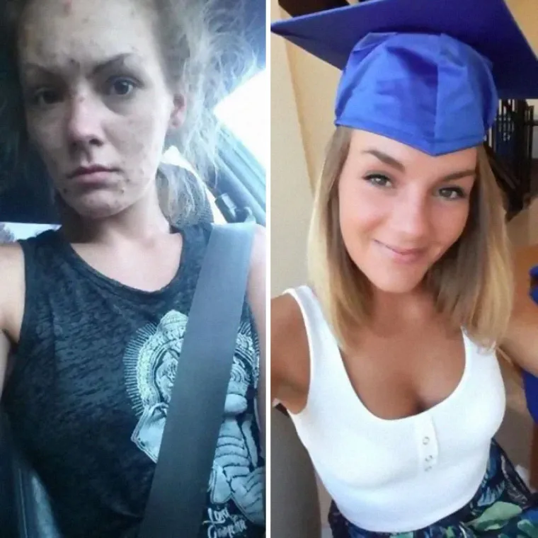 OSTAVILI SU SE DROGE, A DANAS IZGLEDAJU OVAKO: Bivši ovisnici pokazali razlike koje će vas osupnuti
