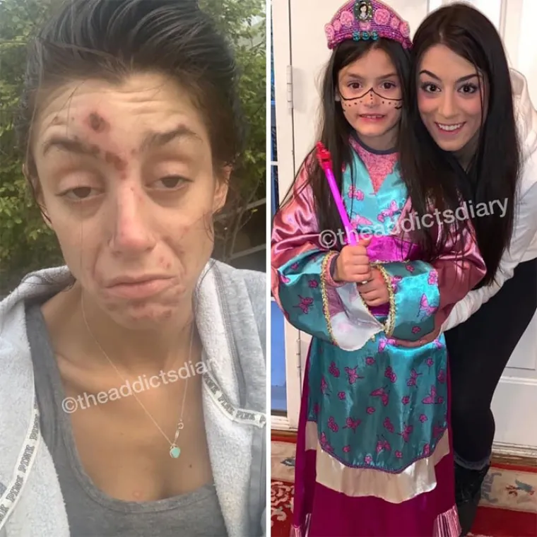 OSTAVILI SU SE DROGE, A DANAS IZGLEDAJU OVAKO: Biv&scaron;i ovisnici pokazali razlike koje će vas osupnuti