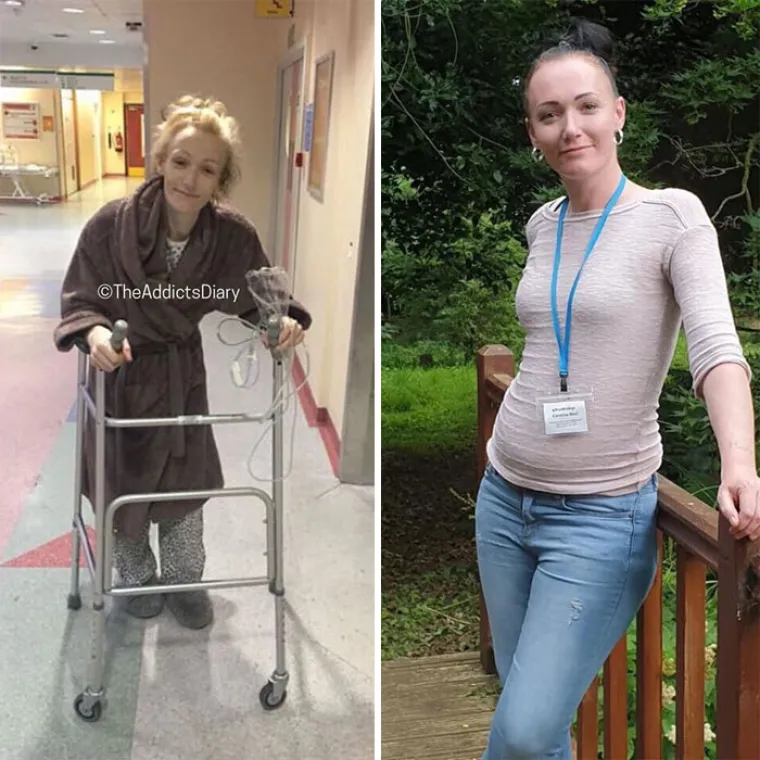 OSTAVILI SU SE DROGE, A DANAS IZGLEDAJU OVAKO: Biv&scaron;i ovisnici pokazali razlike koje će vas osupnuti