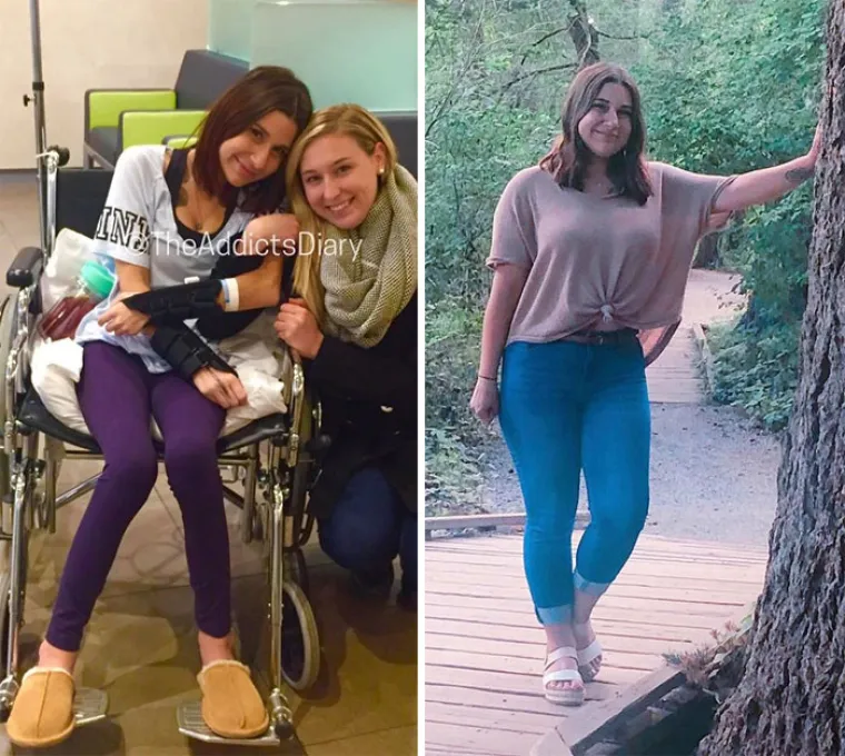 OSTAVILI SU SE DROGE, A DANAS IZGLEDAJU OVAKO: Biv&scaron;i ovisnici pokazali razlike koje će vas osupnuti