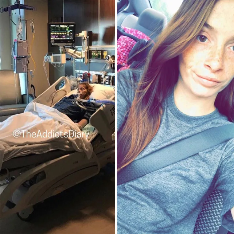 OSTAVILI SU SE DROGE, A DANAS IZGLEDAJU OVAKO: Biv&scaron;i ovisnici pokazali razlike koje će vas osupnuti