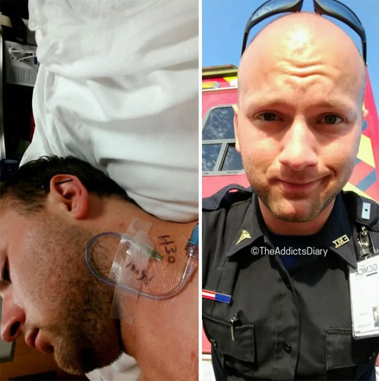 OSTAVILI SU SE DROGE, A DANAS IZGLEDAJU OVAKO: Biv&scaron;i ovisnici pokazali razlike koje će vas osupnuti