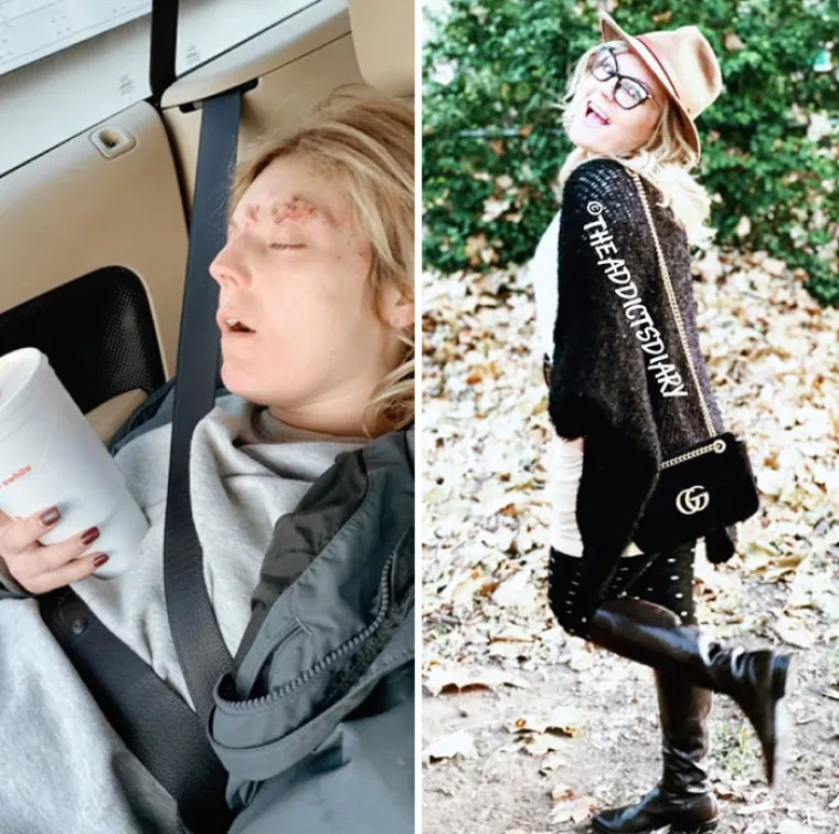 OSTAVILI SU SE DROGE, A DANAS IZGLEDAJU OVAKO: Biv&scaron;i ovisnici pokazali razlike koje će vas osupnuti