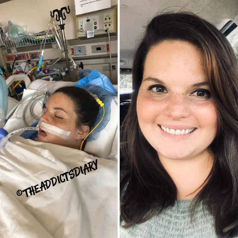 OSTAVILI SU SE DROGE, A DANAS IZGLEDAJU OVAKO: Biv&scaron;i ovisnici pokazali razlike koje će vas osupnuti