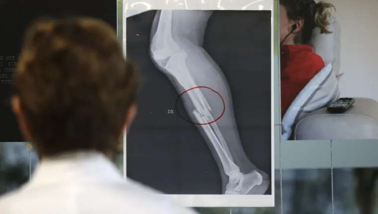 Rendgen govori tisuću riječi: Izložene snimke slomljenih kostiju pretučenih žena