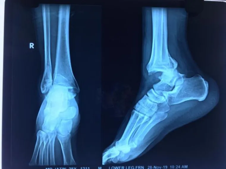 PRVO SU PLAKALI, ONDA SU SE SMIJALI, A ONDA JO&Scaron; MALO PLAKALI: Dan im nije ba&scaron; pro&scaron;ao kako su se nadali