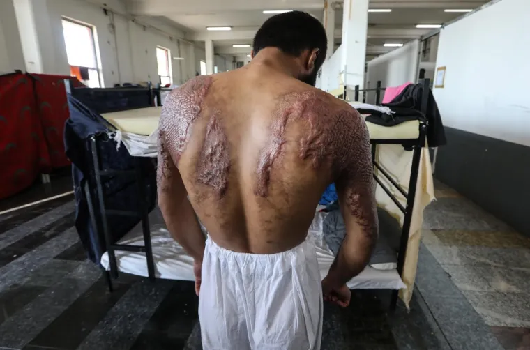 Izbjeglički kamp Miral u Velikoj Kladu&scaron;i zaprima preko tri tisuće migranata. Međunarodna organizacija za migrante IOM pomaže i zbrinjava hranom i medicinskom pomoći izbjeglice iz cijele BiH kojima je to najbliži put za prijelaz u susjednu Hrvatsku, a krajnji im je cilj jedna od zemalja EU-a. Put do slobode, pun je izazova, a migranti nerijetko stradavaju poku&scaron;avajući u te&scaron;kim i neljudskim uvjetima preći granicu.