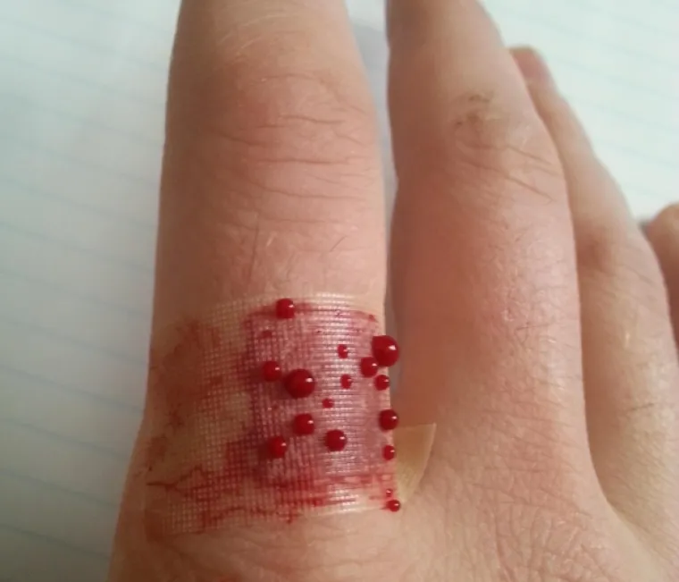 Krv procurila kroz flaster