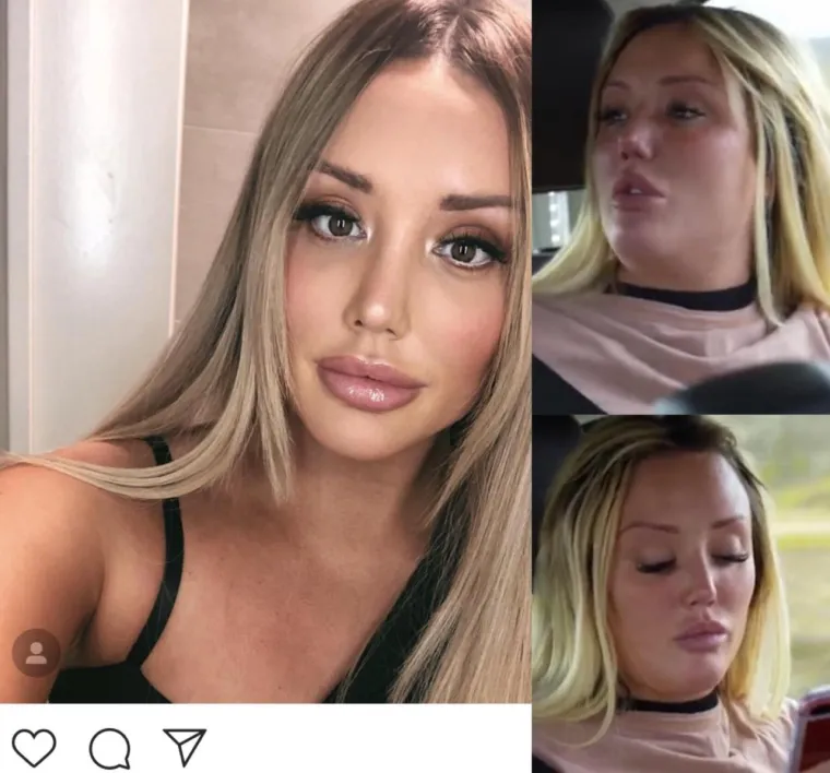 NIKAD VI&Scaron;E NE VJERUJTE INSTAGRAMU: Ovu foto&scaron;op ekipu treba kazniti, ili im barem pokazati osnove anatomskih proporcija