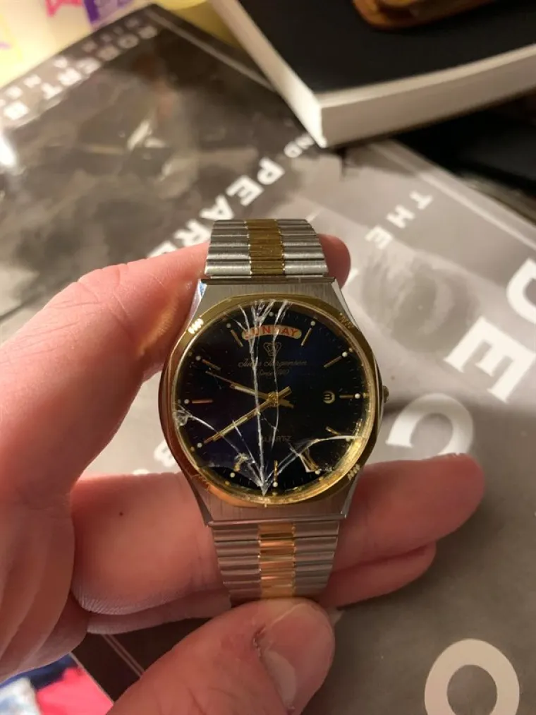 JAO, OD OVOGA PROLAZE TRNCI: Bolna iskustva vječitih pehista - na uvrnut način komična, ali pomalo dižu želudac