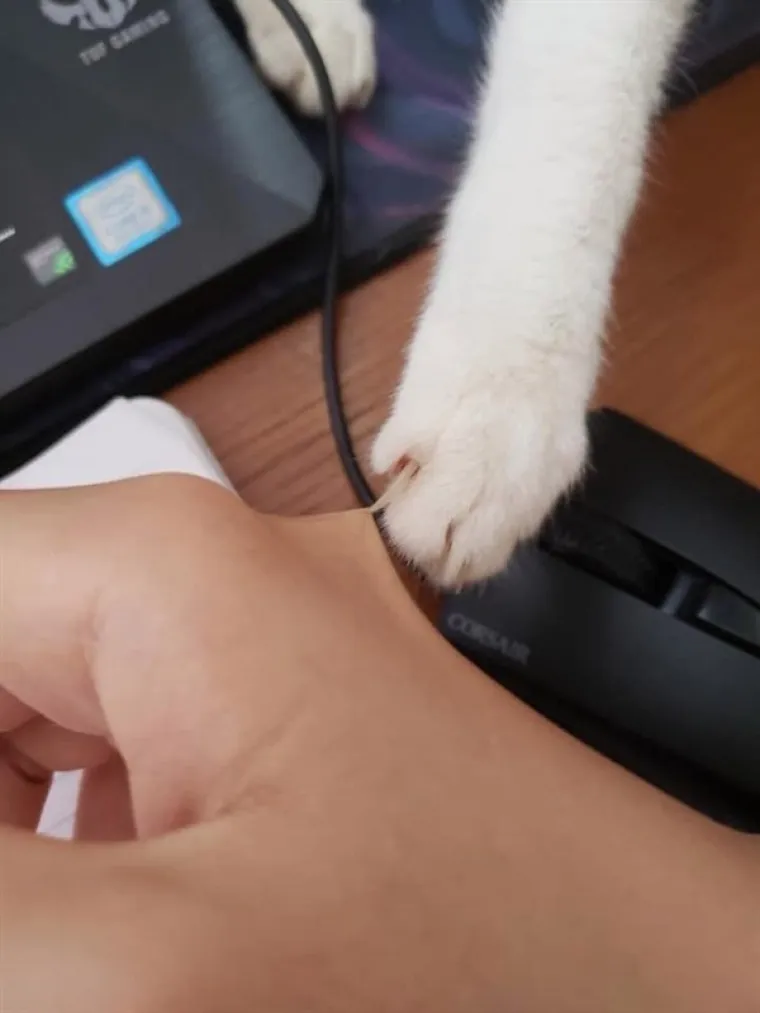 JAO, OD OVOGA PROLAZE TRNCI: Bolna iskustva vječitih pehista - na uvrnut način komična, ali pomalo dižu želudac