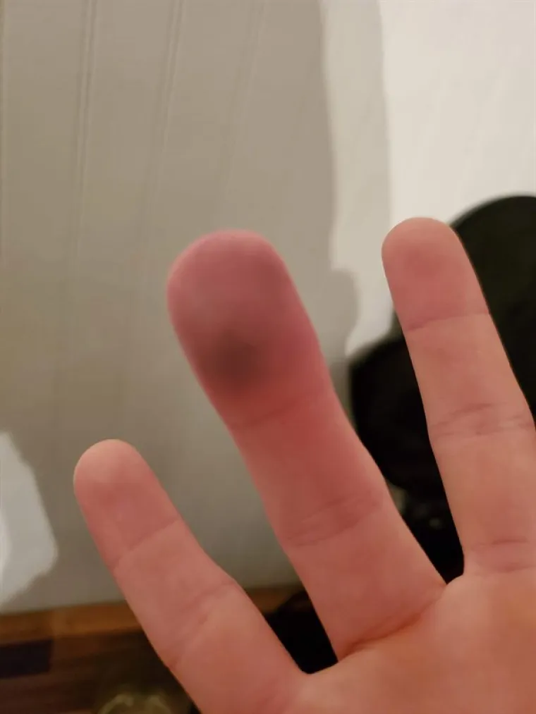 JAO, OD OVOGA PROLAZE TRNCI: Bolna iskustva vječitih pehista - na uvrnut način komična, ali pomalo dižu želudac